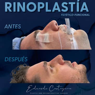 Slider image (7) Dr. Eduardo Cartagena - Plastic Surgeon in Mexico City